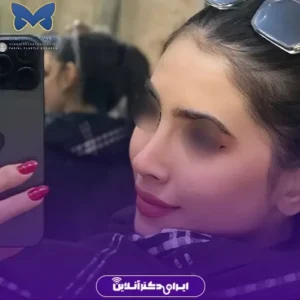 نمونه کار عمل بینی دکتر محمد مجیدی 6