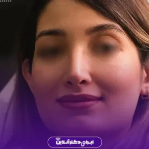 نمونه کار عمل بینی دکتر محمد مجیدی 8