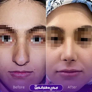 نمونه کار عمل بینی دکتر رضا وقردوست 4