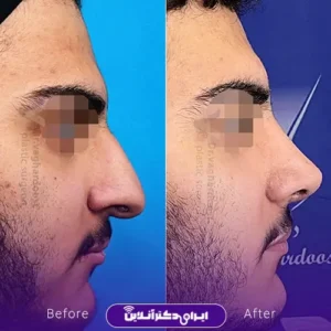 نمونه کار عمل بینی دکتر رضا وقردوست 6