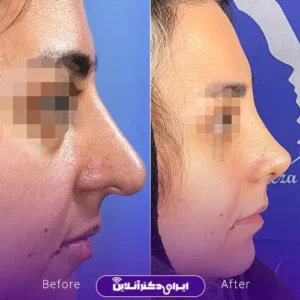 نمونه کار عمل بینی دکتر رضا وقردوست 7