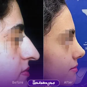 نمونه کار عمل بینی دکتر رضا وقردوست 9