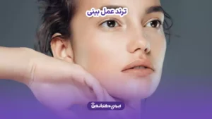 ترند عمل بینی