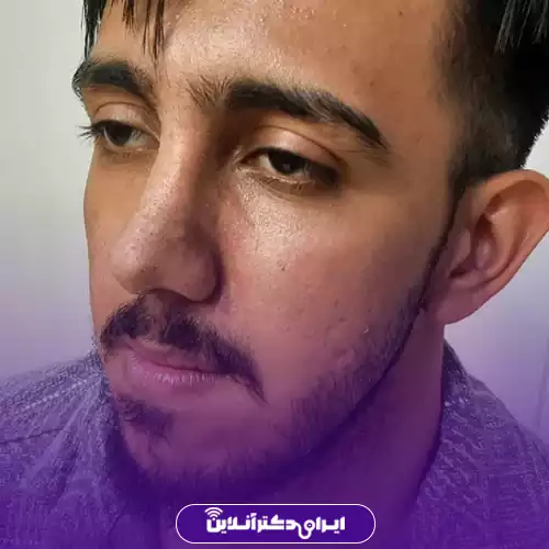 نمونه عمل بینی گوشتی دکتر علیرضا خاک‌نژاد در کرج