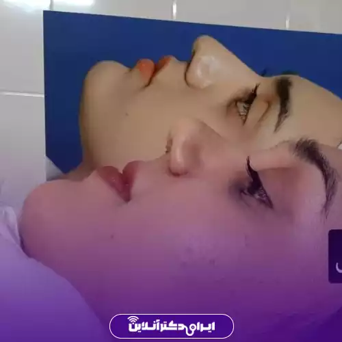 نمونه کار جراحی بینی گوشتی دکتر علیرضا خاک‌نژاد در کرج