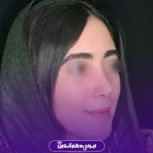 نمونه کار عمل بینی دکتر کتایون انصاری 3