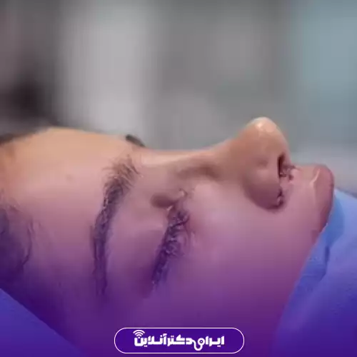 نمونه کار عمل بینی دکتر سیده وحیده موسوی بایگی 1