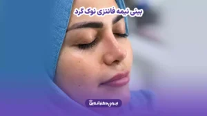 بینی نیمه فانتزی نوک گرد