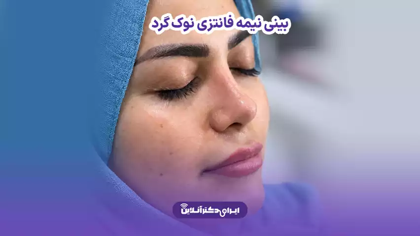 بینی نیمه فانتزی نوک گرد