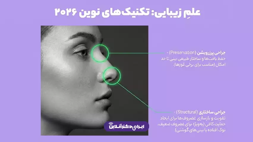 ترند عمل بینی 2026 (الان چه مدل بینی مده؟) 27 جدیدترین رویکردها و تکنیکهای عمل بینی در سال ۲۰۲۶