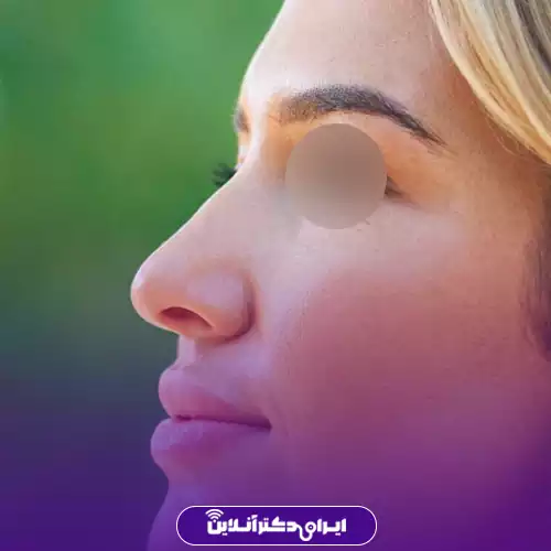 بینی قوزدار ترند 2